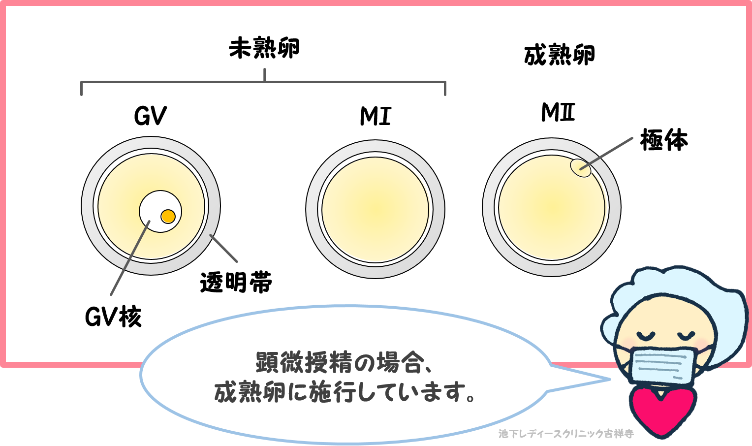 採卵時の成熟卵と未成熟卵について 池下レディースクリニック吉祥寺